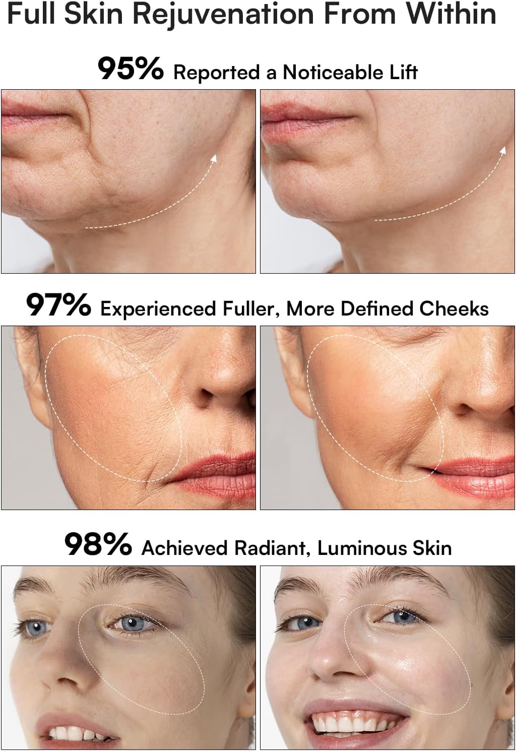 INIA 3-in-1 Red Light Therapy Device for Face & Neck – Firming & Puffiness Relief (White)